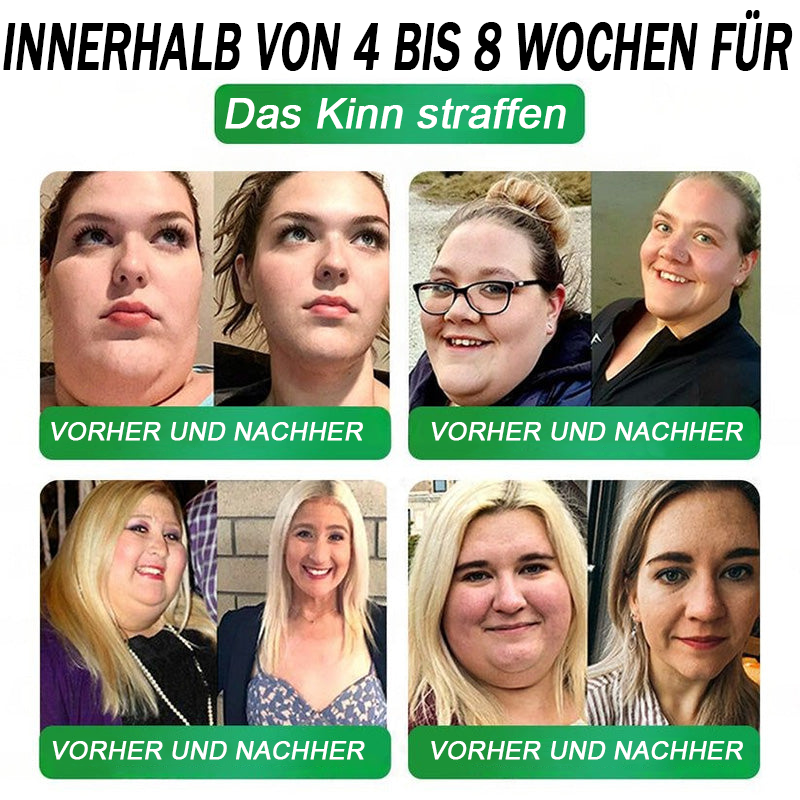 BfArM-Shop | Natravor® 8-in-1 Orallösung – Mit 100 Mrd. aktiven Probiotika ✅ Unterstützt Gewichtsmanagement, Herz, Darm & Frauengesundheit, strafft die Haut und steigert die Energie.