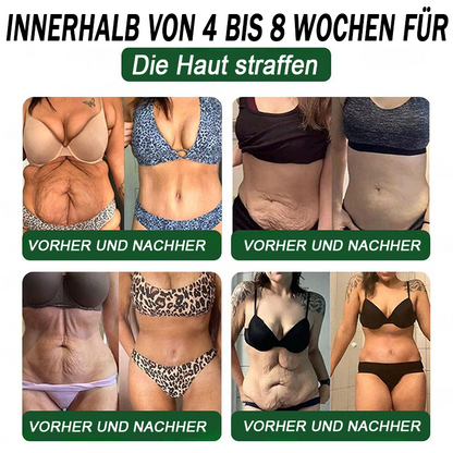BfArM-Shop | Natravor® 8-in-1 Orallösung – Mit 100 Mrd. aktiven Probiotika ✅ Unterstützt Gewichtsmanagement, Herz, Darm & Frauengesundheit, strafft die Haut und steigert die Energie.