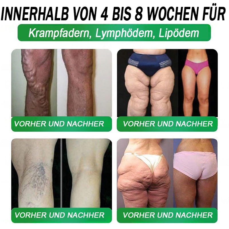BfArM-Shop | Natravor® 8-in-1 Orallösung – Mit 100 Mrd. aktiven Probiotika ✅ Unterstützt Gewichtsmanagement, Herz, Darm & Frauengesundheit, strafft die Haut und steigert die Energie.