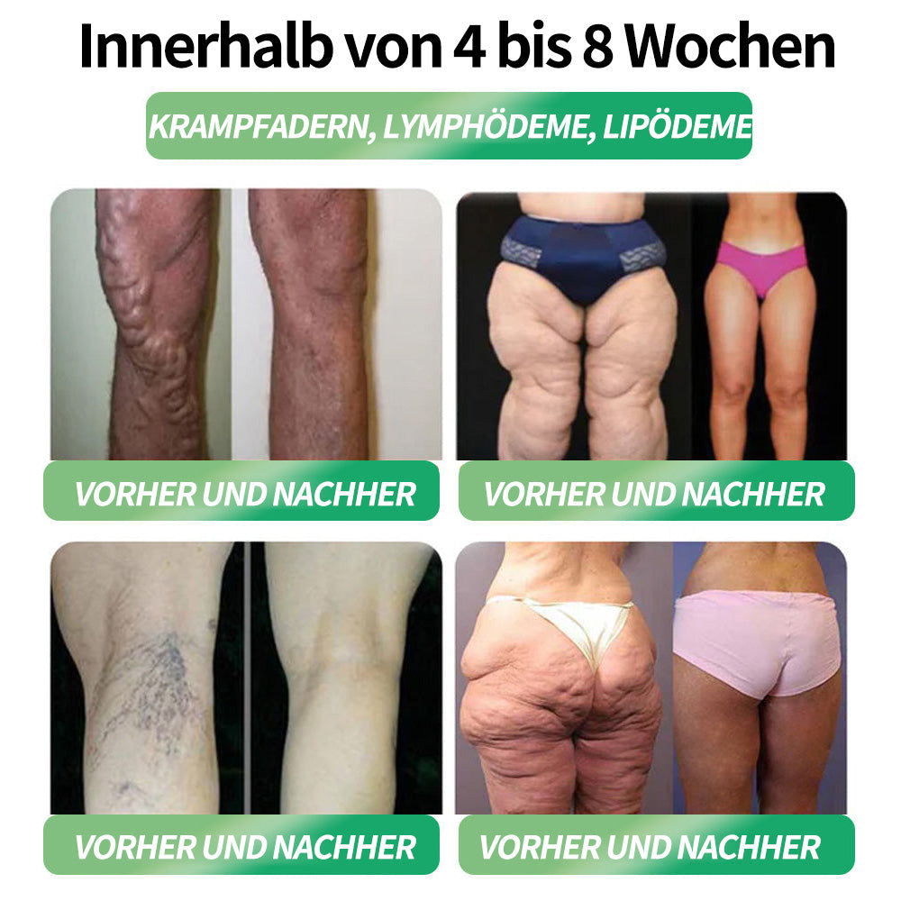 BfArM-Shop | Natravor® NAD 6-in-1 Gesundheits-Orallösung (Eine Dosis pro Tag, sichtbare Veränderungen in 7 Tagen) ✅ Geeignet bei Fettleibigkeit, kardiovaskulärer Gesundheit, Diabetes, Schlafapnoe, Gelenkproblemen und mehr.